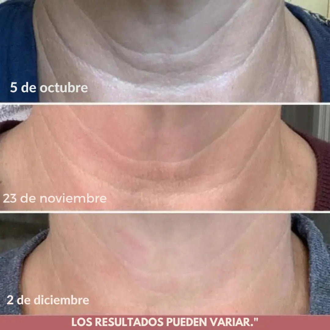 Recupera La Firmeza de Tu Cuello y Luce 10 Años Más Joven Con RevitaNeck