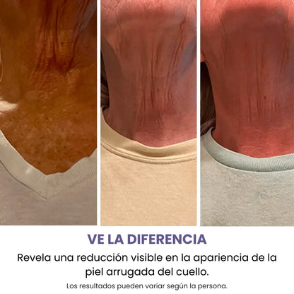 Recupera La Firmeza de Tu Cuello y Luce 10 Años Más Joven Con RevitaNeck