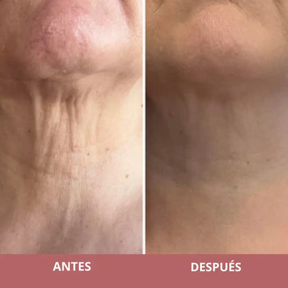 Recupera La Firmeza de Tu Cuello y Luce 10 Años Más Joven Con RevitaNeck